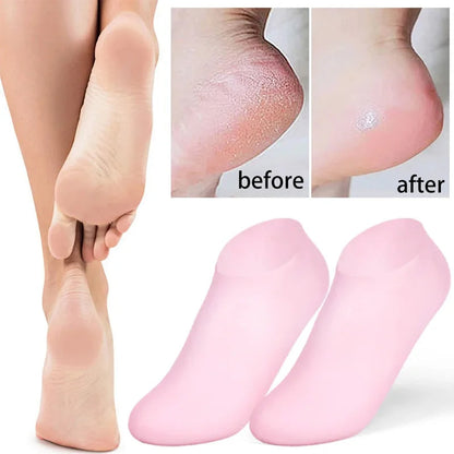 Silicone Gel Heel Socks for Cracked Heels – Moisturizing & Repair
